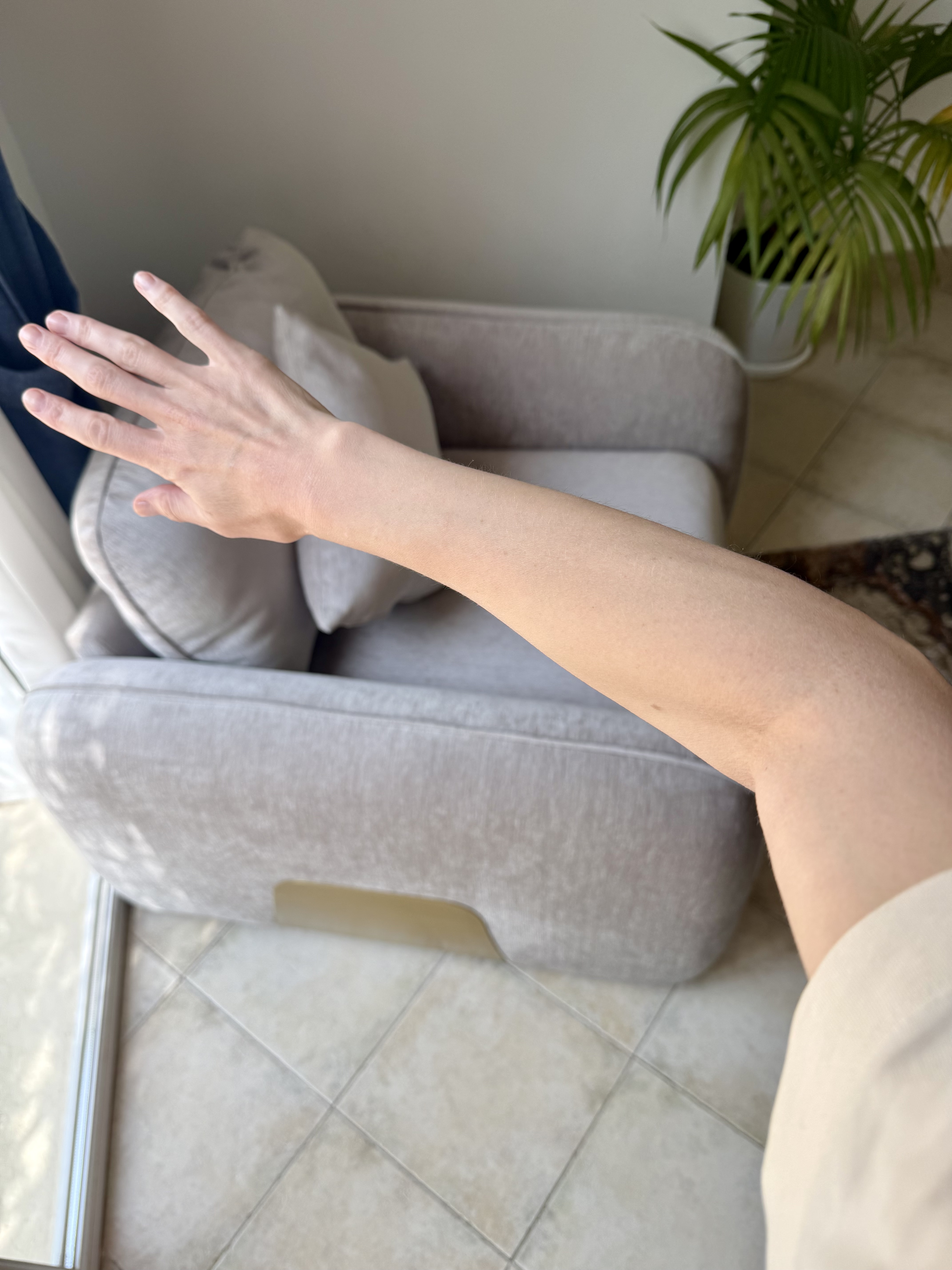 Arm, healed